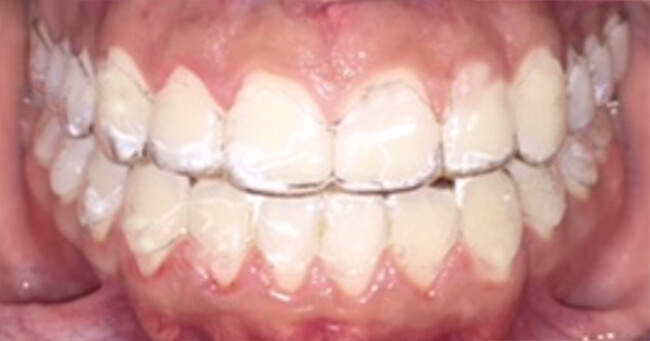 Figura 19. intraoral frente