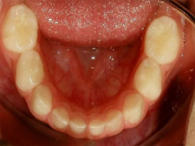 Fig 9 inferior