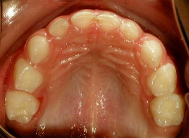 Fig 18. Vista oclusal superior