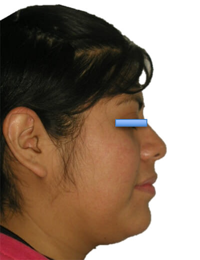 Fig. 2 Perfil