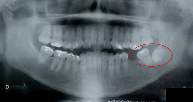 Fig. 3 Radiografía Panorámica