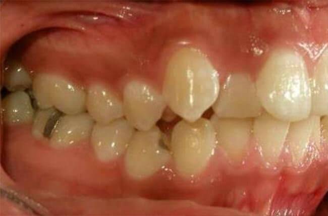 Fig. 4 Lateral derecha