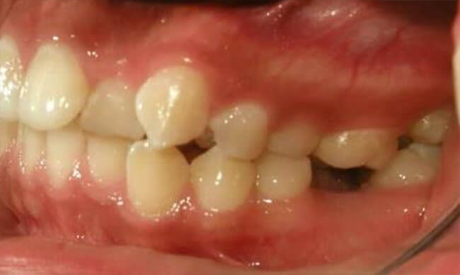 Fig.5 Lateral izquierda