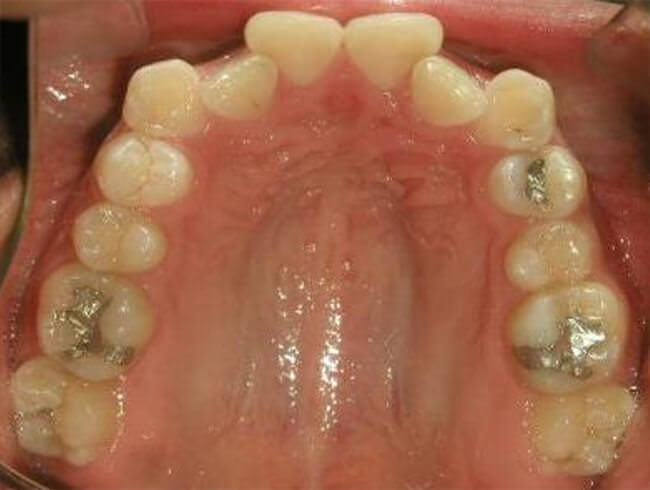 Fig. 7 Oclusal superior