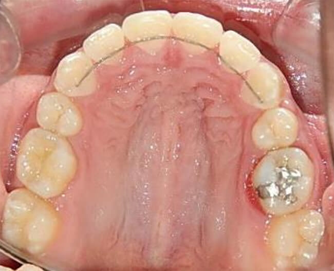 Fig. 20 Oclusal superior