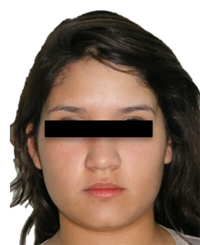 Fig. 1 Frente de inicio