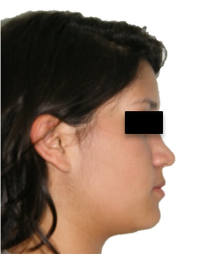 Fig. 2 Perfil