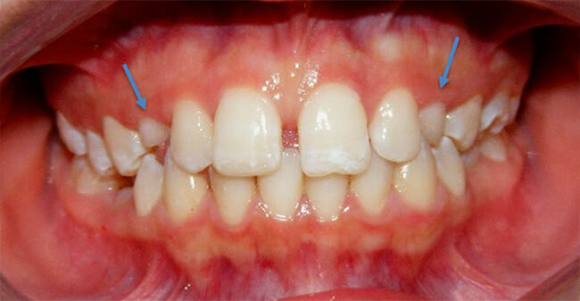 Fig. 4 Intraoral de frente