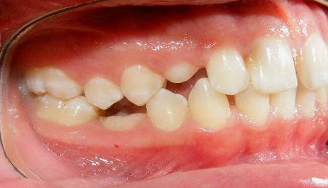 Fig. 5 Intraoral derecha