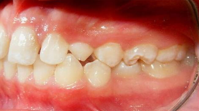 Fig. 6 Izquierda