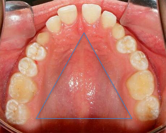 Fig. 7 Oclusal superior