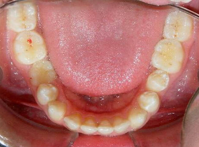 Fig. 8 Oclusal inferior