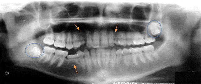 Fig. 10 Radiografía panorámica