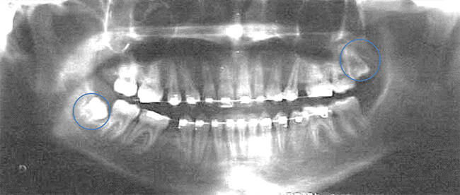 Fig. 19 Radiografía panorámica