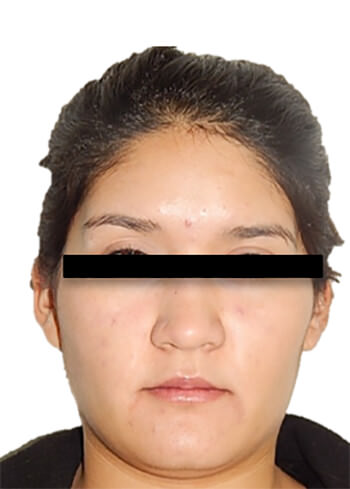 Fig. 21 Frente