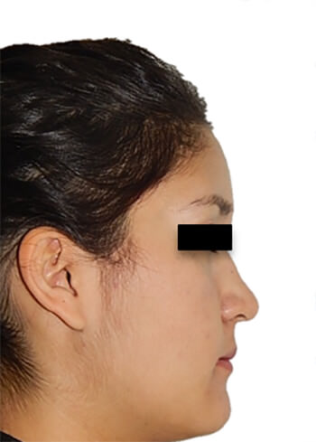 Fig. 22 Perfil