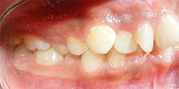 Fig. 2 Intraoral de frente