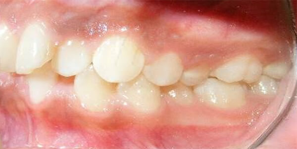 Fig. 2 Intraoral de frente