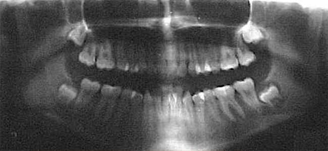 Fig. 7 Rx. Panorámica de inicio