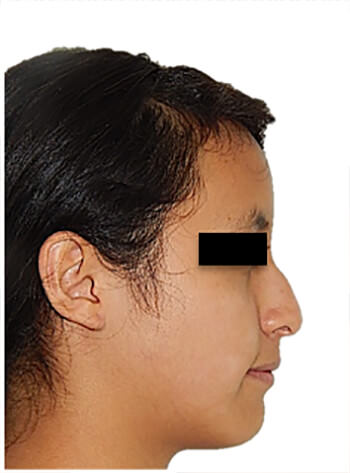 Fig. 10 Perfil