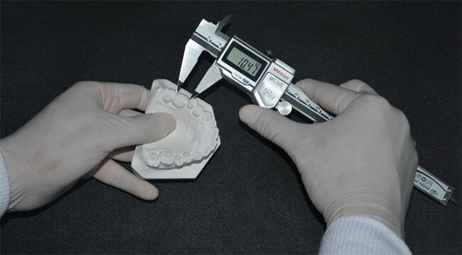 Figura 1 Medición manual posterior