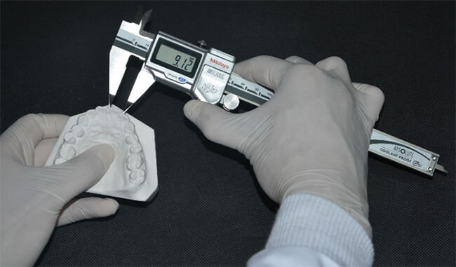 Figura 2 Medición manual anterior