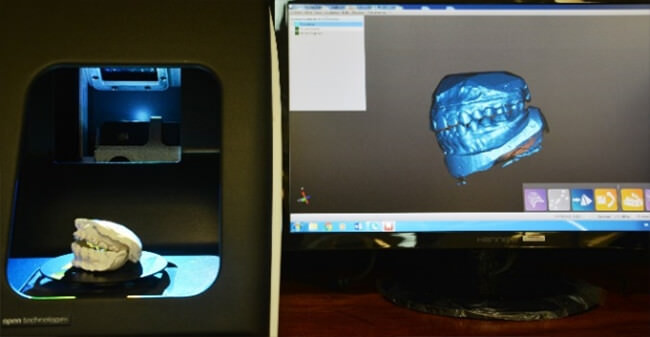 Figura 3 Escaneo y Digitalización de modelos