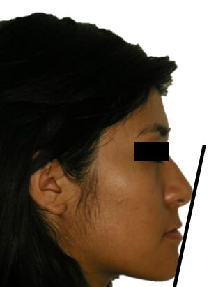 Figura 3 Perfil inicio