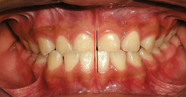 Figura. 4 Intraoral de frente
