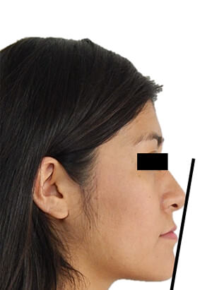 Figura 13 Perfil progreso