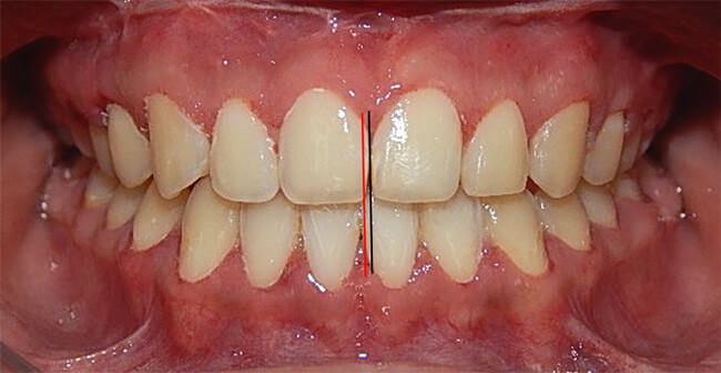 Fig. 24 Intraoral frente final