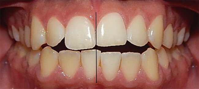Fig.3 Intraoral de frente sonrisa