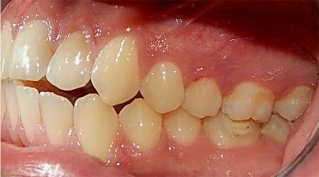 Fig.5 Lateral izquierda