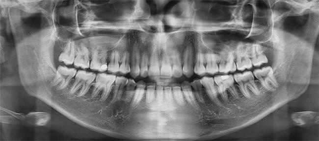 Fig.7 Radiografía panorámica