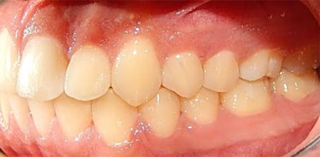 Fig.16 Lateral izquierda