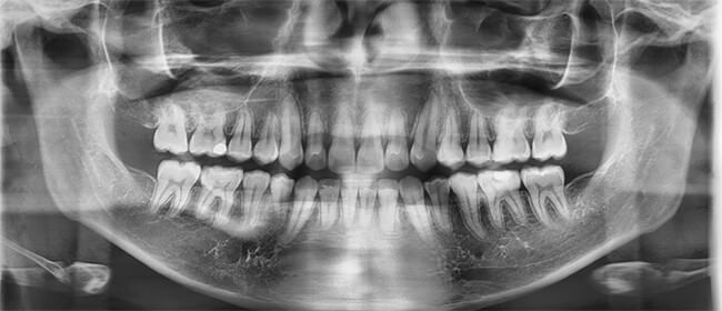Fig.19 Radiografía panorámica