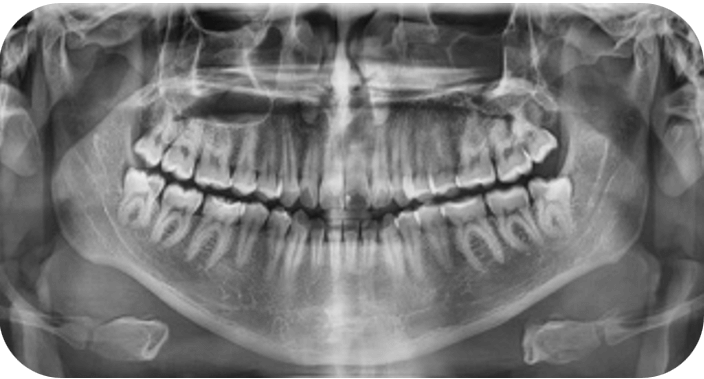 Fig 10. Panoramica inicial