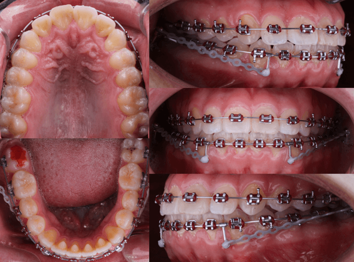 Fig 12. Seguimiento fotografico