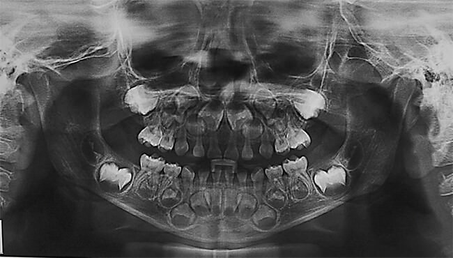Fig. 3 Radiografía Panorámica, dentro de los rangos de normalidad