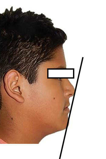 Figura 2 Perfil