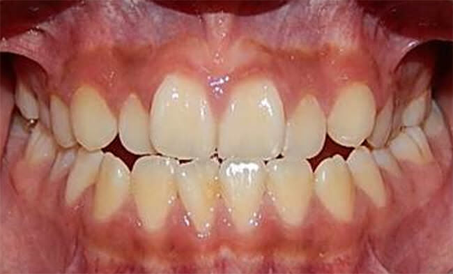 Figura 3 Frente intraoral