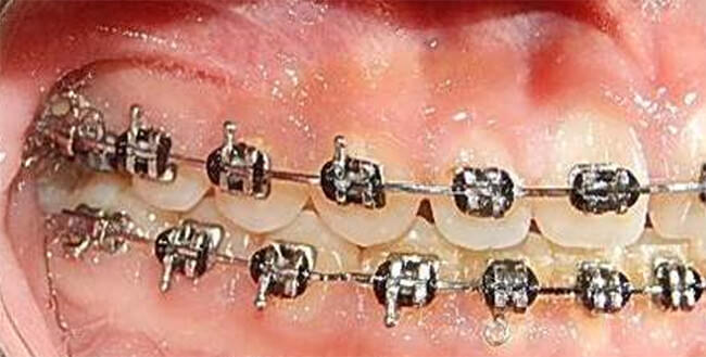 Figura 8 Intraoral derecha