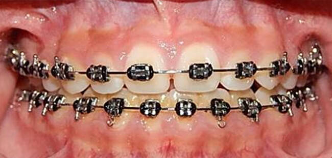 Figura 9 Intraoral Frente