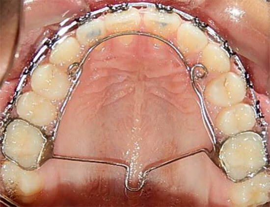 Figura 10 Oclusal