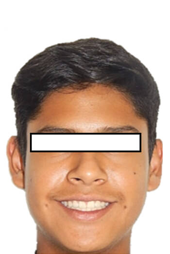 Figura 11 Extraoral de frente