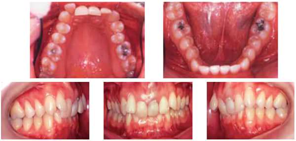 Fig.6 Fotos intraorales