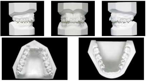 Fig.7 Modelos de estudio