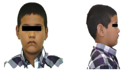 Figura 1 Fotografías Extraorales
