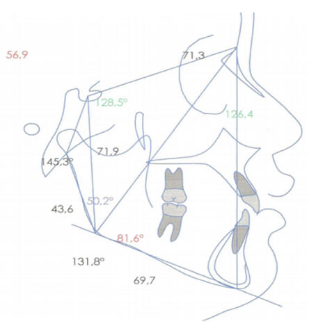 Figura 10 Estudios Cefalométricos intermedio