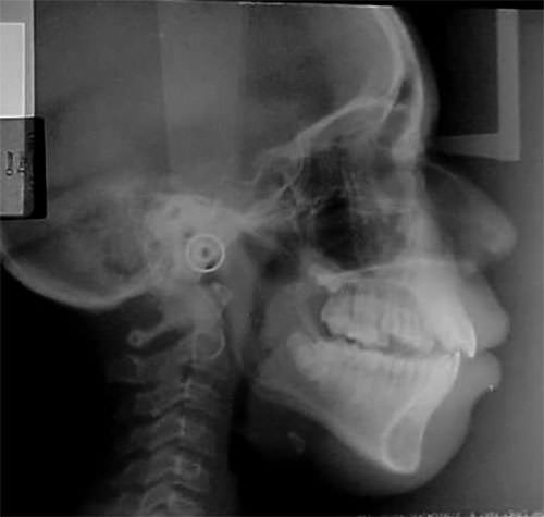 Fig. 1 Rx Cefálica
